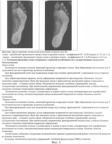 Способ определения рессорной функции стопы с использованием возрастающей нагрузки (патент 2358650)