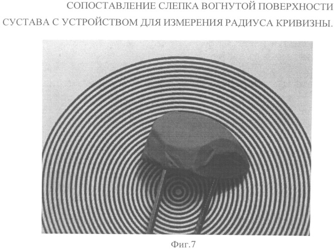 Устройство и способ для определения радиуса кривизны суставных поверхностей (патент 2492837)