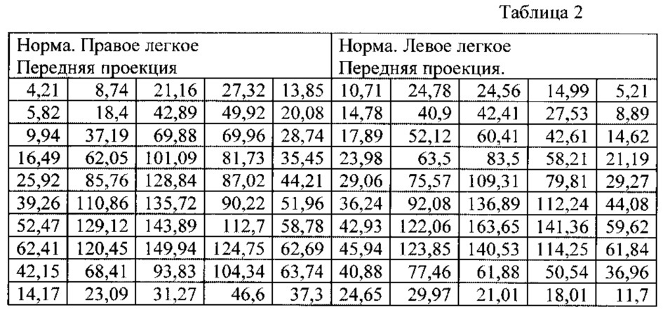 Способ количественного определения накопления радиофармпрепарата при радионуклидном исследовании перфузии легких (патент 2629044)