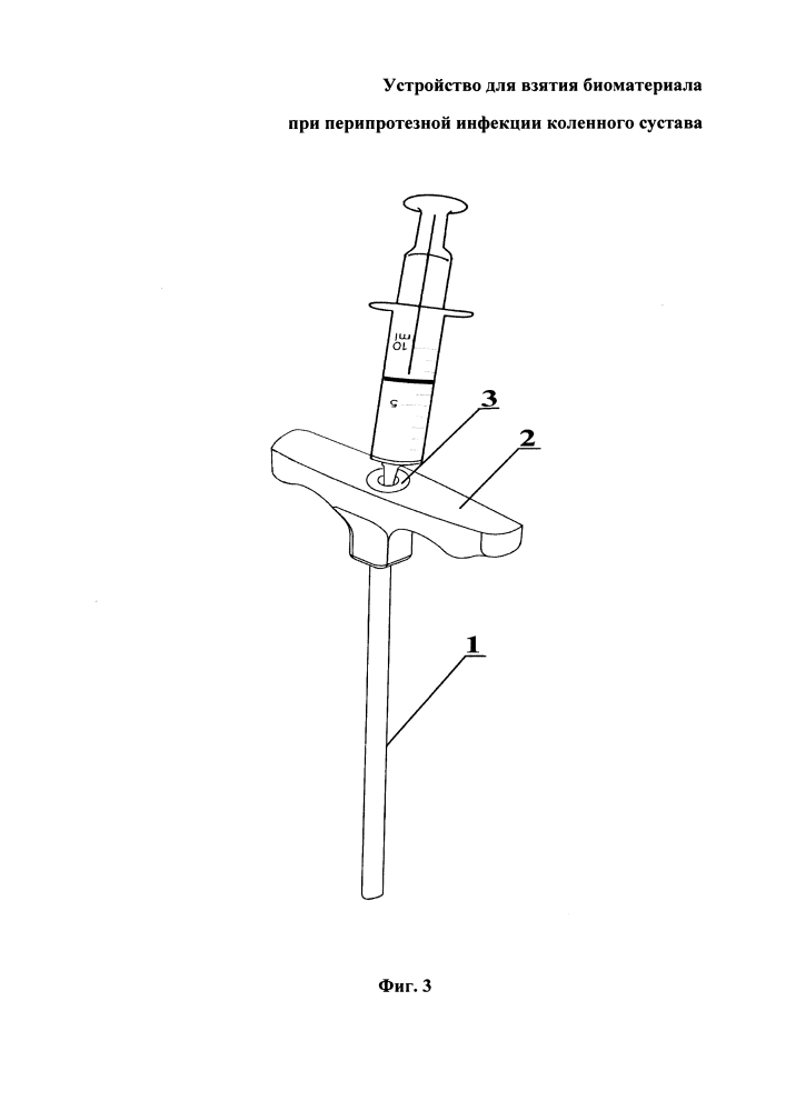 Устройство для взятия биоматериала при перипротезной инфекции коленного сустава (патент 2638786)