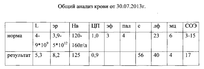 Способ комплексного лечения ожирения при синдроме поликистозных яичников (патент 2564439)