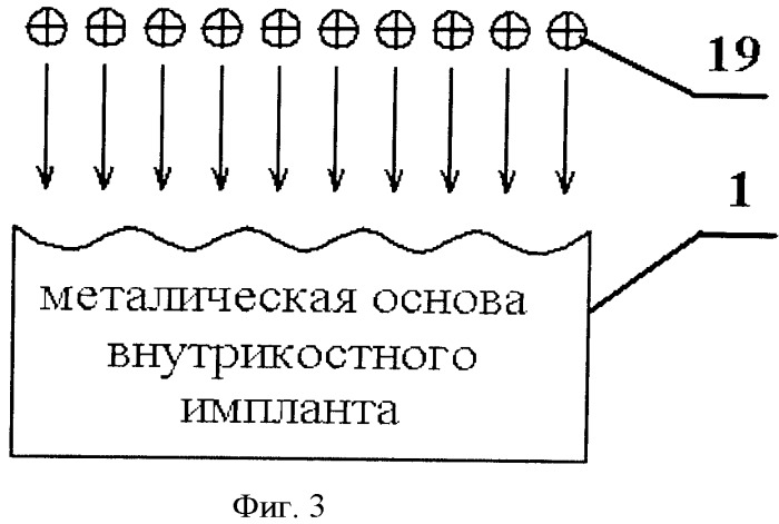 Способ изготовления внутрикостного имплантата с ионно-лучевой модификацией (патент 2530568)