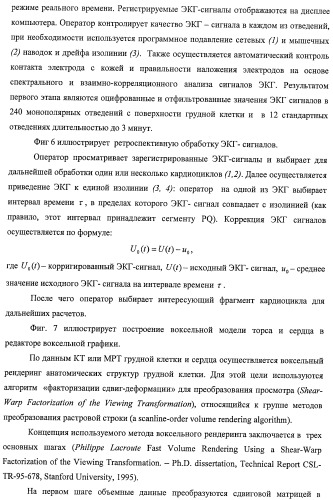 Способ неинвазивного электрофизиологического исследования сердца (патент 2417051)