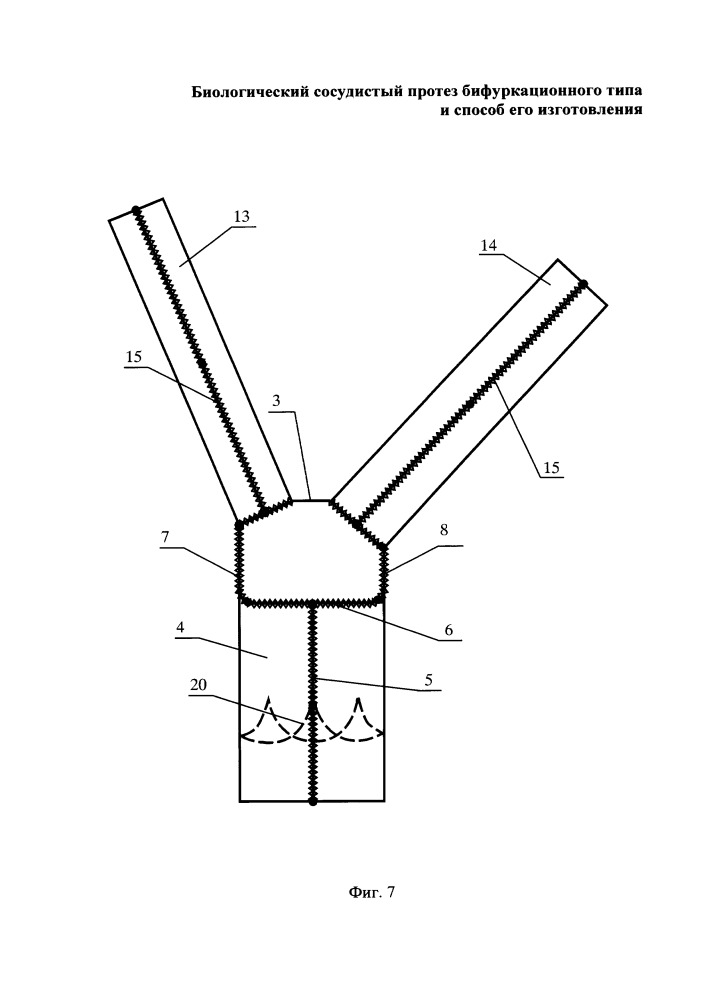 Биологический сосудистый протез бифуркационного типа и способ его изготовления (патент 2652870)