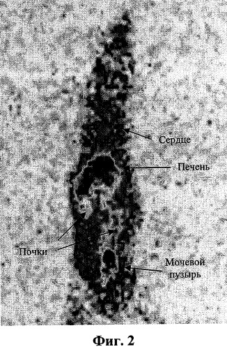 Способ радионуклидной маркировки бактерий кишечной палочки для сцинтиграфических исследований (патент 2290643)