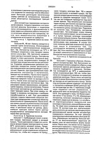 Устройство для удаления конкрементов из полых органов (патент 2003291)