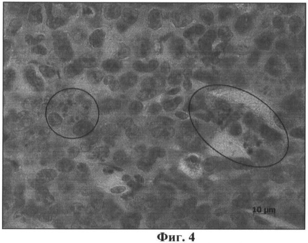 Штамм вируса болезни ньюкасла для создания на его основе кандидатного противоракового препарата и изучения механизмов онколизиса (патент 2482129)
