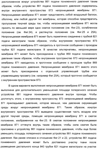 Устройство для лечения путем подкожной подачи пониженного давления с использованием разделения с помощью воздушного баллона (патент 2401652)