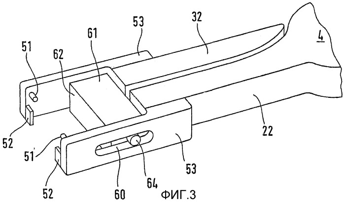 Система из шейного протеза и установочного инструмента (патент 2309707)