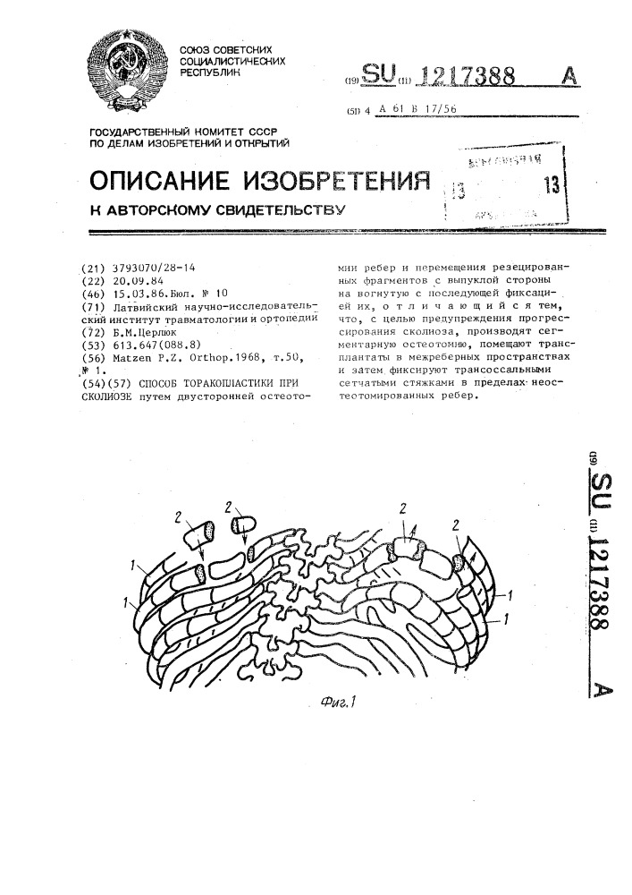 Способ торакопластики при сколиозе (патент 1217388)