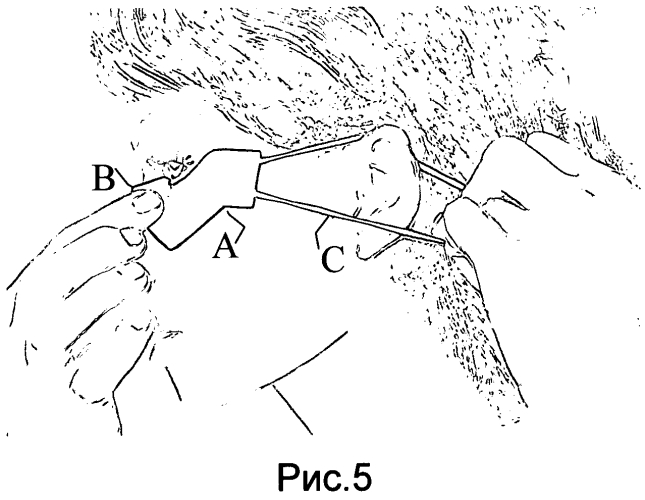 Щит-бабочка для ресниц (патент 2553568)