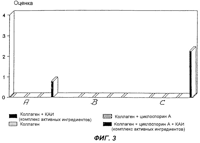 Имплантат для восстановления позвонков и трубчатых костей (патент 2261116)