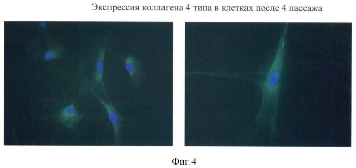 Способ получения фибробластоподобных клеток из пупочного канатика новорожденного (патент 2384618)