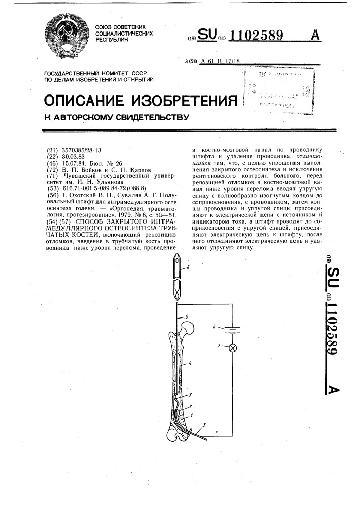 Способ закрытого интрамедуллярного остеосинтеза трубчатых костей (патент 1102589)