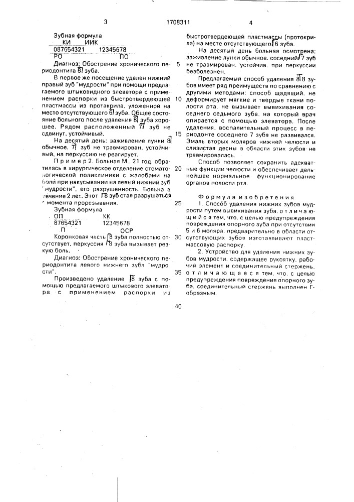 Способ удаления нижних зубов мудрости и устройство для его осуществления (патент 1708311)