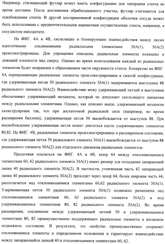 Баллонный расширяющийся стент, способный на восстановление расширения (патент 2388433)