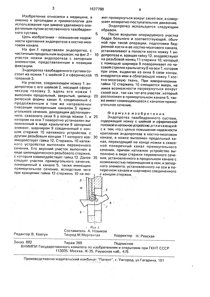 Эндопротез тазобедренного сустава (патент 1637788)