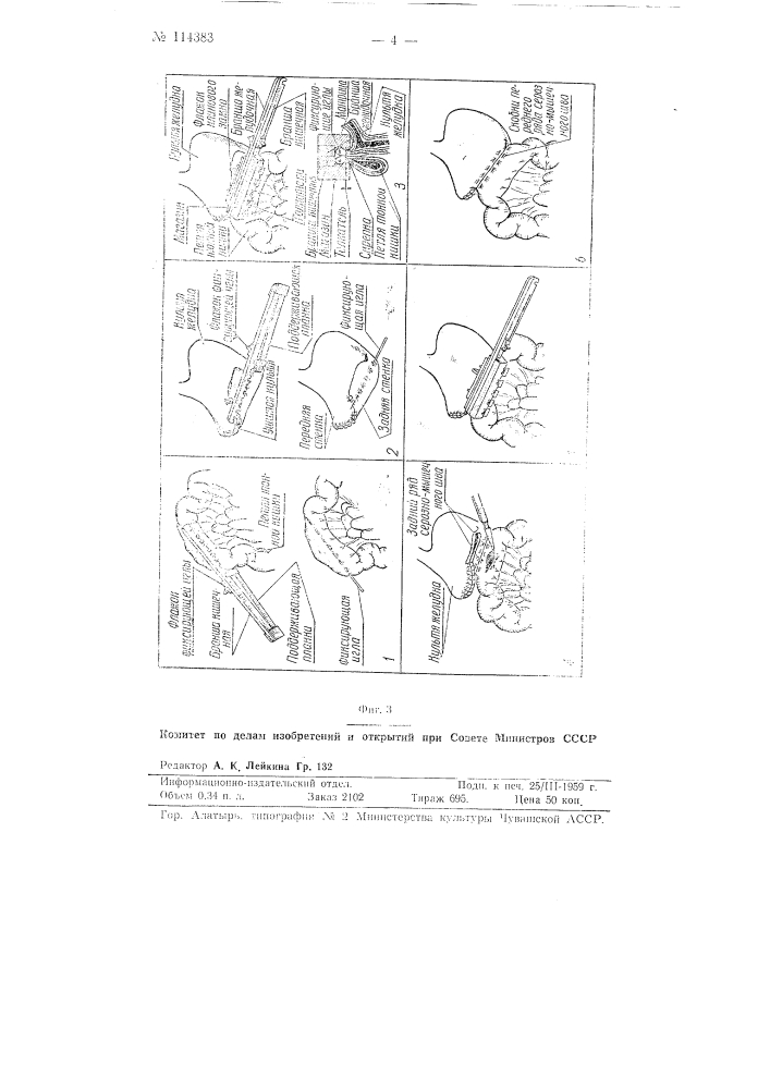 Аппарат для наложения серозно-мышечных швов из танталовых скрепок (патент 114383)