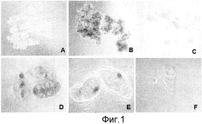 Способы in vitro для создания и поддержания линий растительных клеток в виде отдельных клеток в суспензии с интактными клеточными стенками и их трансформации (патент 2451744)