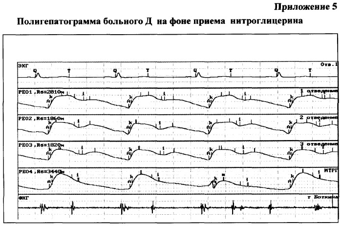 Способ и устройство для оценки гемодинамики печени (патент 2372022)