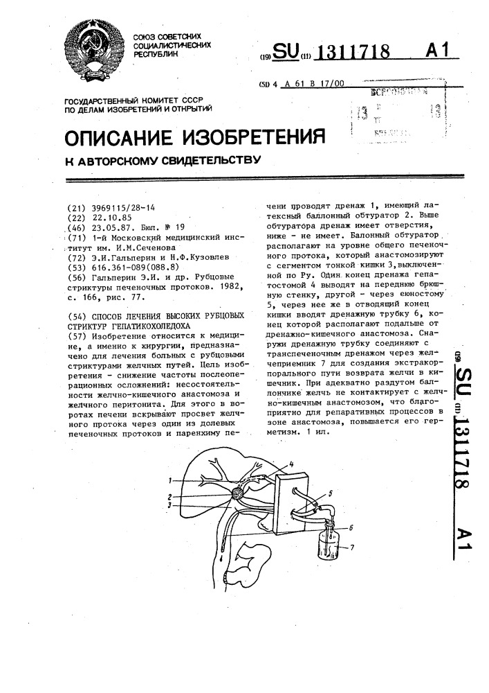 Способ лечения высоких рубцовых стриктур гепатикохоледоха (патент 1311718)