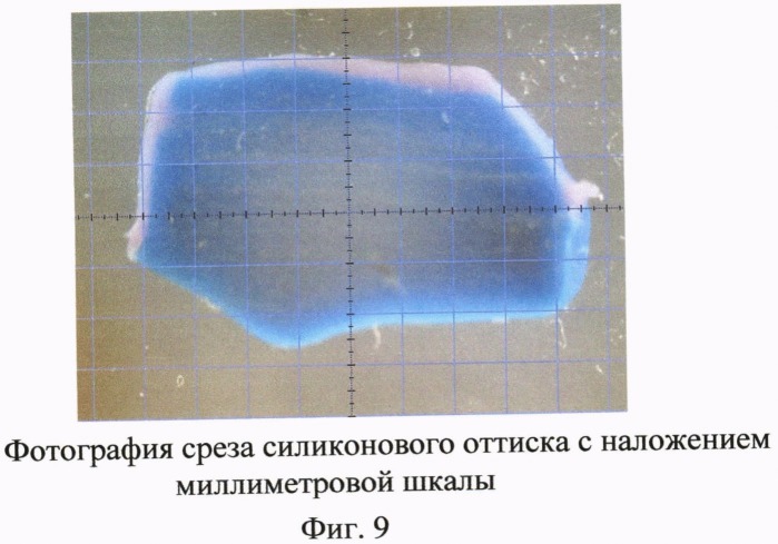 Способ клинической оценки точности изготовления несъемных зубных протезов (патент 2491033)