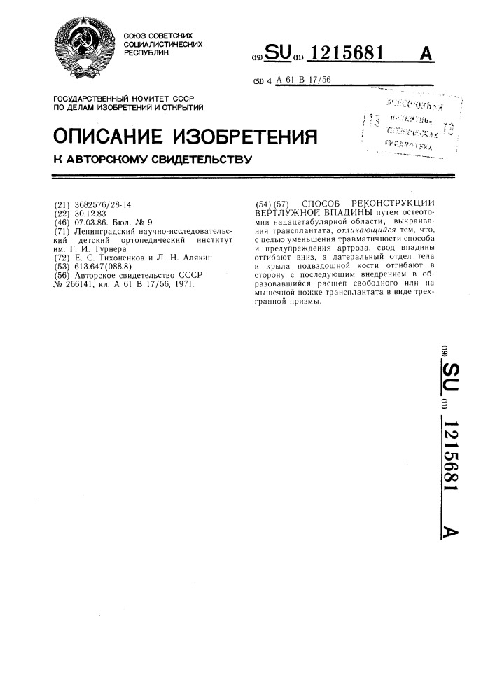 Способ реконструкции вертлужной впадины (патент 1215681)