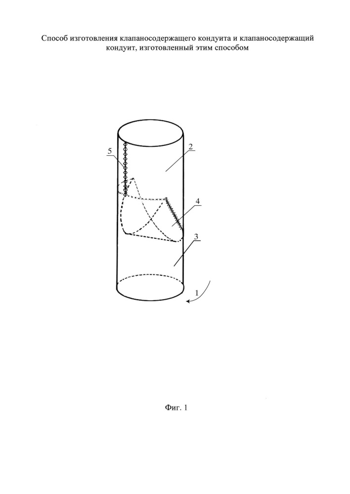 Способ изготовления клапаносодержащего кондуита и клапаносодержащий кондуит, изготовленный этим способом (патент 2641171)
