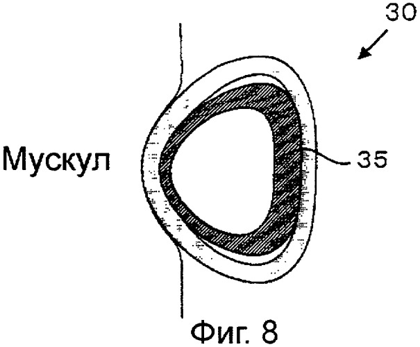 Устройство для укрепления мускулов (патент 2329846)