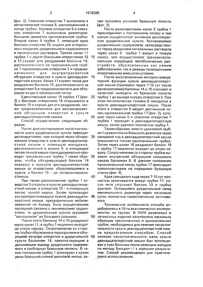 Способ лечения несостоятельности швов дуоденальной культи после резекции желудка по бильрот-11 (патент 1678385)