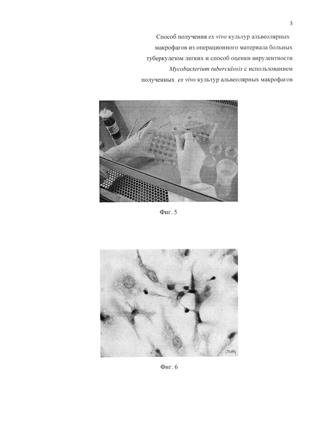 Способ получения ex vivo культур альвеолярных макрофагов из операционного материала больных туберкулезом легких и способ оценки вирулентности mycobacterium tuberculosis с использованием полученных ex vivo культур альвеолярных макрофагов (патент 2593725)