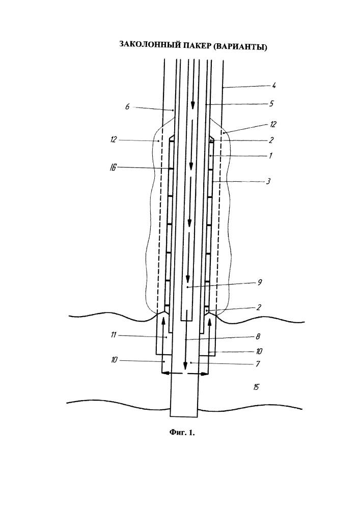 Заколонный пакер (варианты) (патент 2660951)