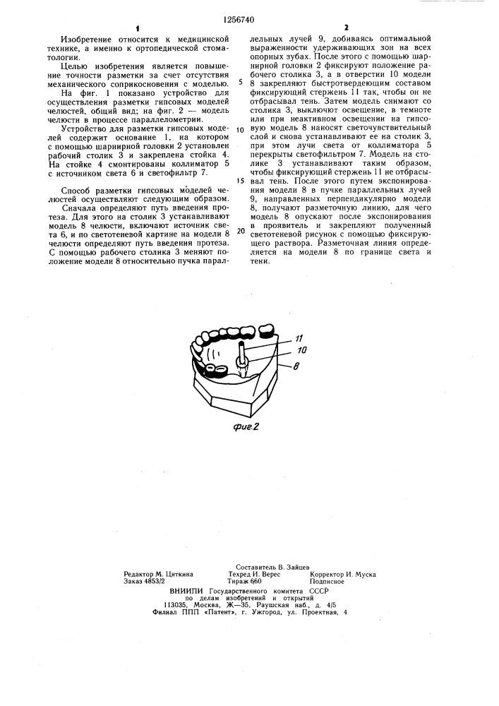 Способ разметки гипсовой модели челюсти (патент 1256740)