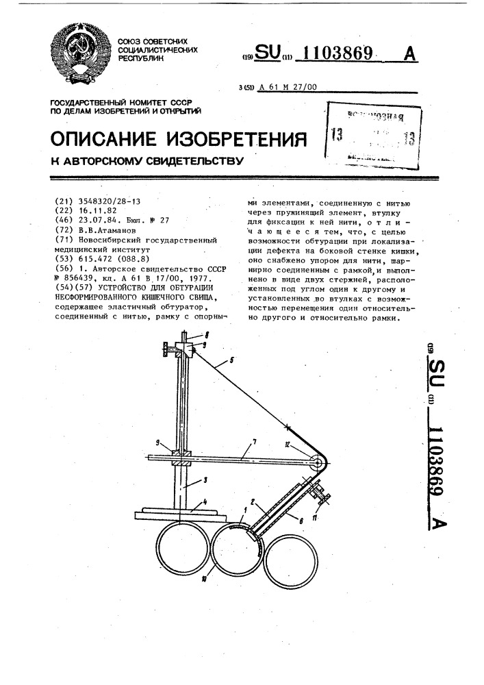 Устройство для обтурации несформированного кишечного свища (патент 1103869)