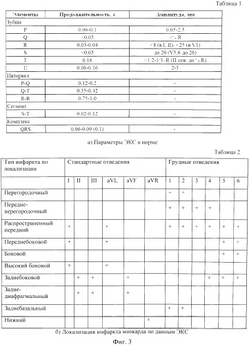 Устройство для регистрации электрокардиосигналов в условиях свободной двигательной активности (патент 2540528)