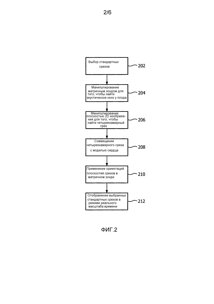 Автоматическое позиционирование стандартных плоскостей для оценки сердца плода в режиме реального времени (патент 2654611)