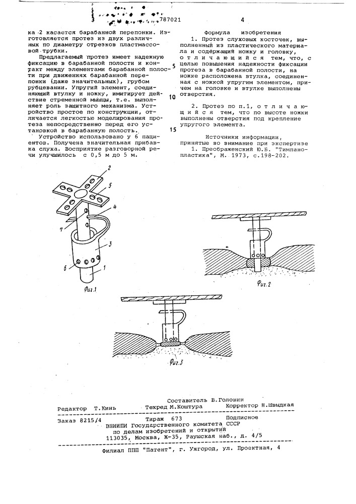 Протез слуховых косточек (патент 787021)