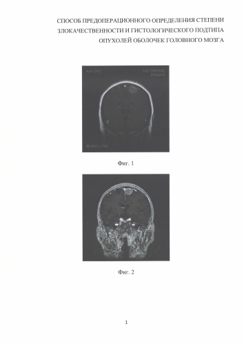 Способ предоперационного определения степени злокачественности и гистологического подтипа опухолей оболочек головного мозга (патент 2589652)