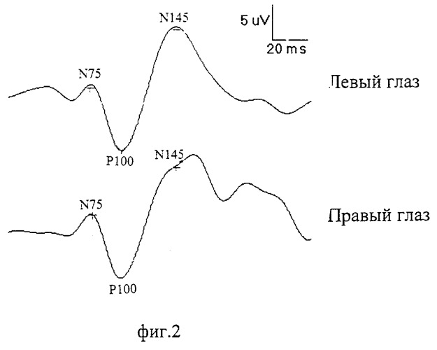 Способ лечения поражений зрительного анализатора (патент 2264241)