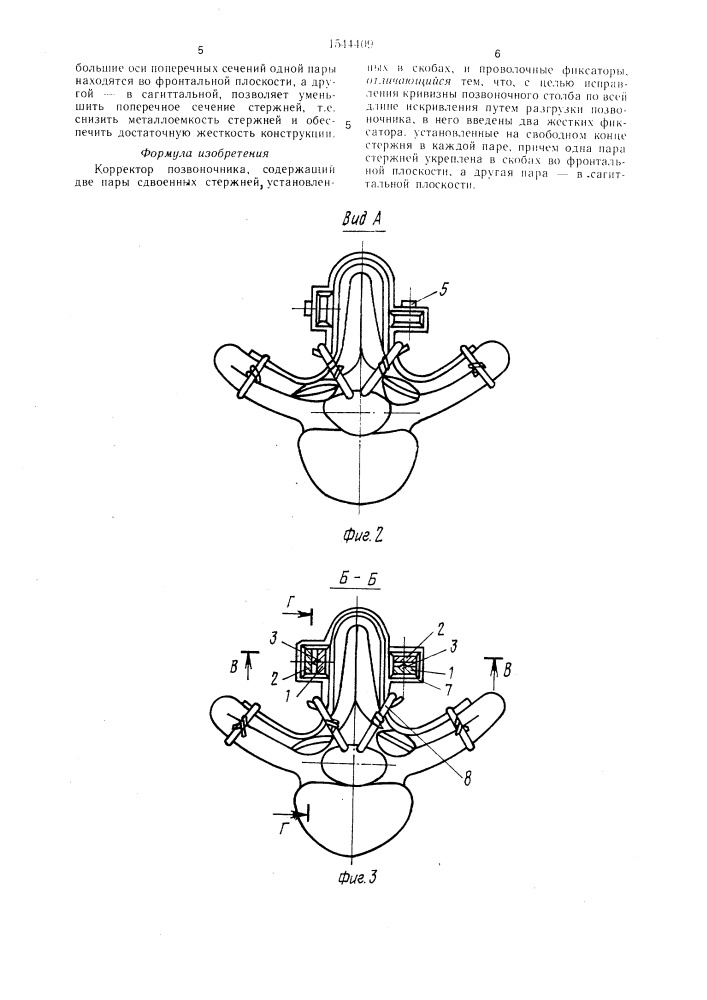 Корректор позвоночника (патент 1544409)