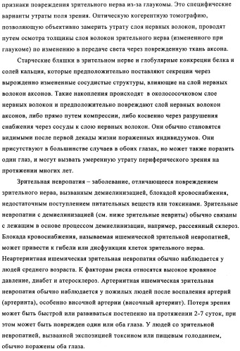 Применение антитела против амилоида-бета при глазных заболеваниях (патент 2482876)