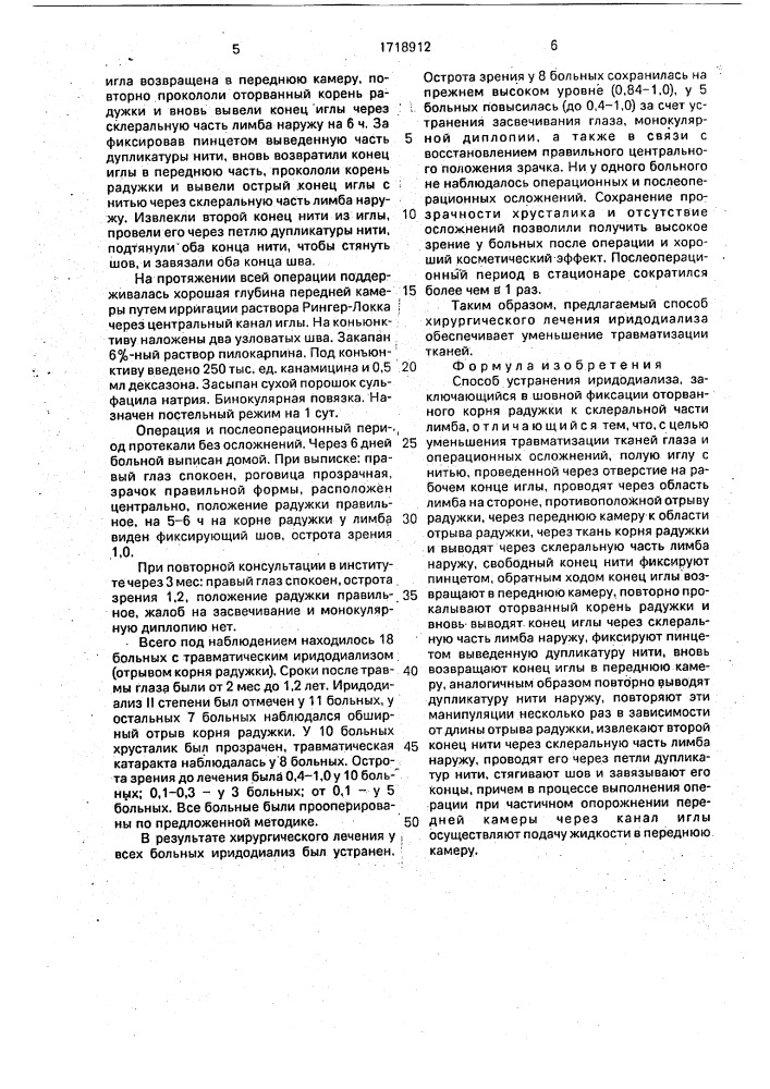 Способ устранения иридодиализа (патент 1718912)