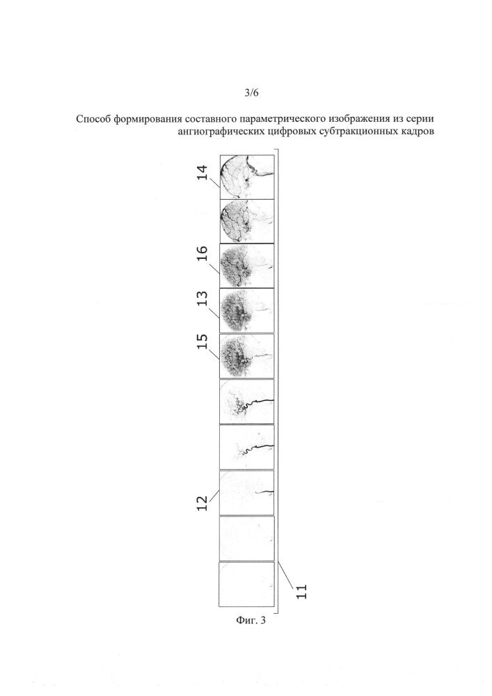 Способ формирования составного параметрического изображения из серии ангиографических цифровых субтракционных кадров (патент 2627270)
