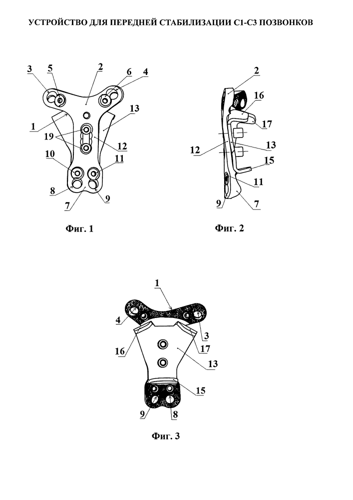Устройство для передней стабилизации с1-с3 позвонков (патент 2615901)
