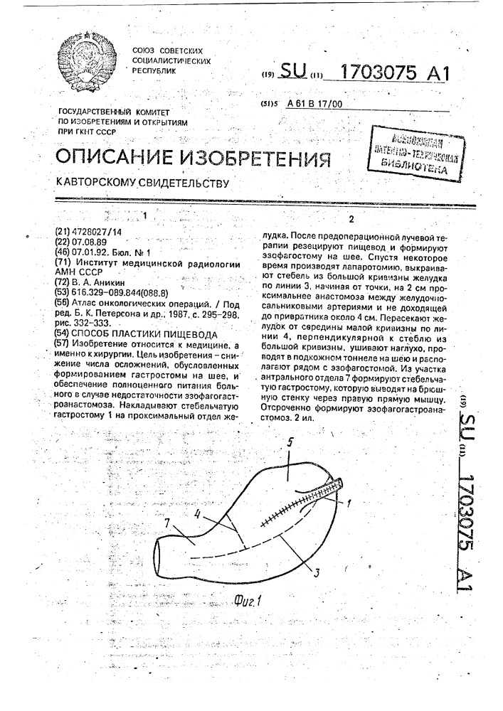 Способ пластики пищевода (патент 1703075)