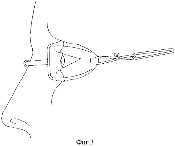 Малые интра-орбитальные очки для плавания (патент 2433850)