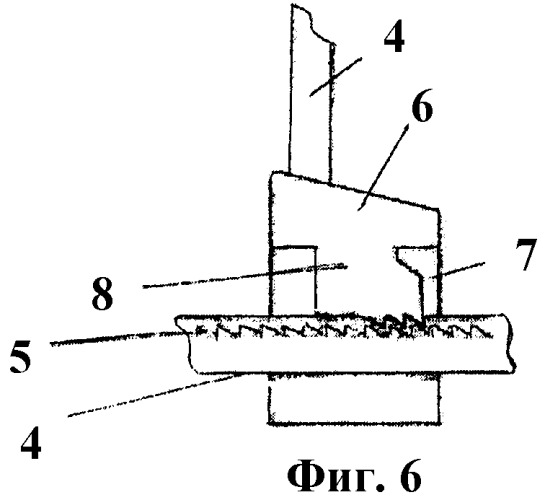 Способ и система иммобилизации при переломах челюстей, ленточная шина и крепежный элемент для их осуществления (патент 2445048)