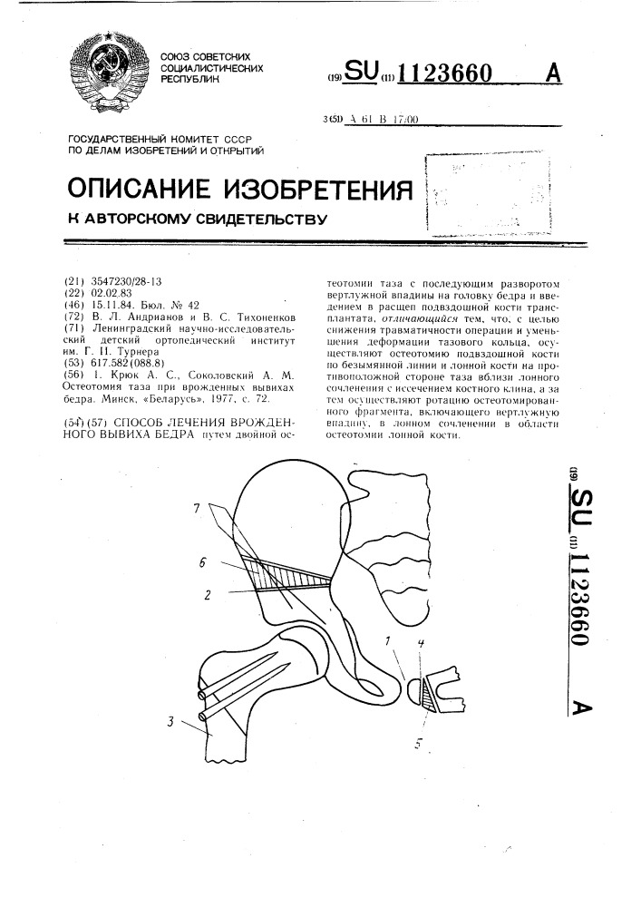 Способ лечения врожденного вывиха бедра (патент 1123660)