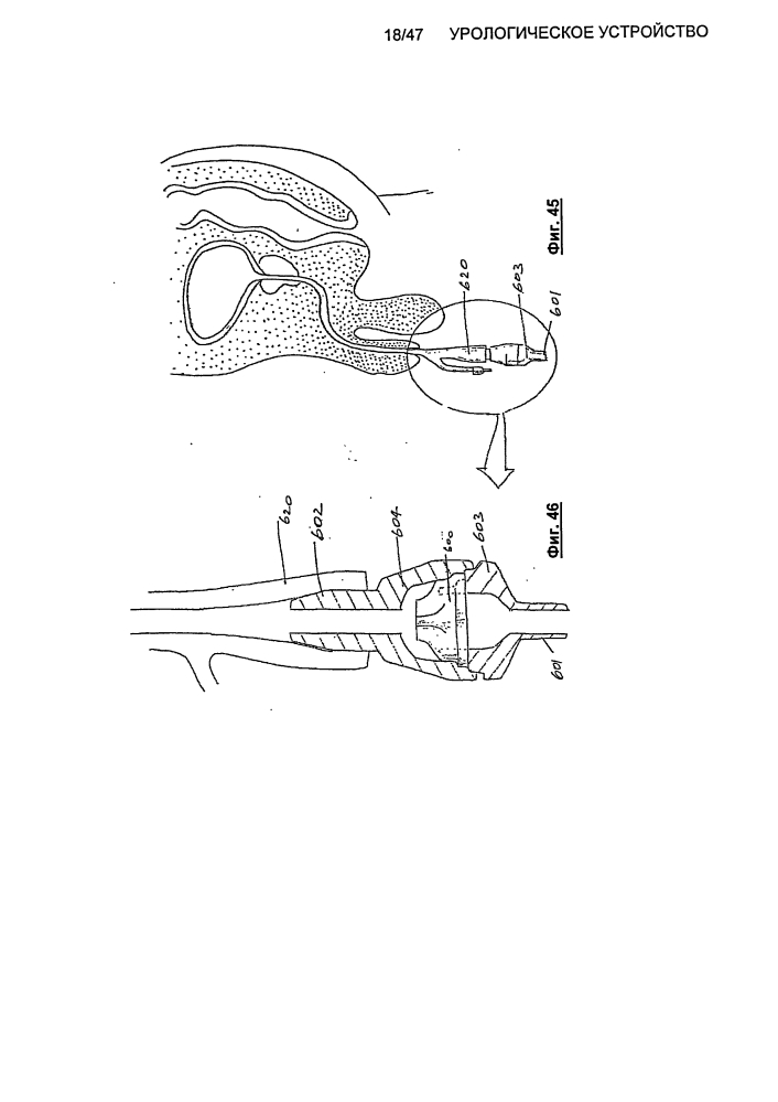 Урологическое устройство (патент 2600865)