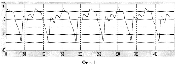 Способ сжатия и восстановления речевых сигналов для систем кодирования с переменной скоростью передачи (патент 2394284)